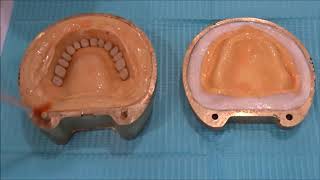 Processing of Complete dentures [upl. by Phelgon]