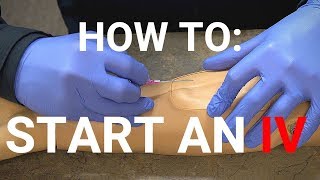 How To Start An IV [upl. by Eirrot]