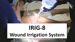 IRIG8 Wound Irrigation System Trial [upl. by Gildus664]