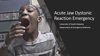 Acute Jaw Dystonic Reaction Emergency [upl. by Mich]