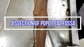 Dissection of Popliteal Fossa [upl. by Fabrin762]