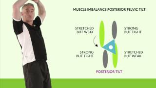 Posture  Correcting Posterior Pelvic Tilt [upl. by Justin]