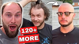 BALDING Men BeforeAfter Going FULL BALD 1 [upl. by Andrade]