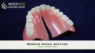 Denture Repair in Airdrie AB  Woodside Denture Centre [upl. by Egief389]