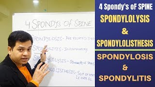 Spondylosis Spondylolisthesis Spondylitis Spondylolysis Cervical and Lumbar spondylosis [upl. by Ajnek]